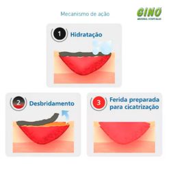 Curatec Hidrogel com Alginato