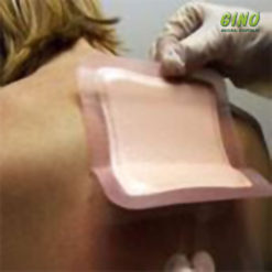 Allevyn Adesivo Classic 12,5cm X 12,5cm