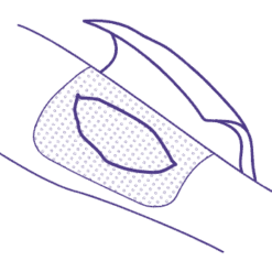 Membracel Membrana Regeneradora Porosa